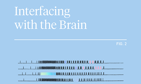 Neuralink